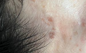 ultrasun-tanning-and-beauty-chester-saltney